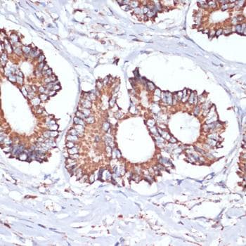Polyclonal Rabbit anti-Human UBE2O Antibody (IHC)