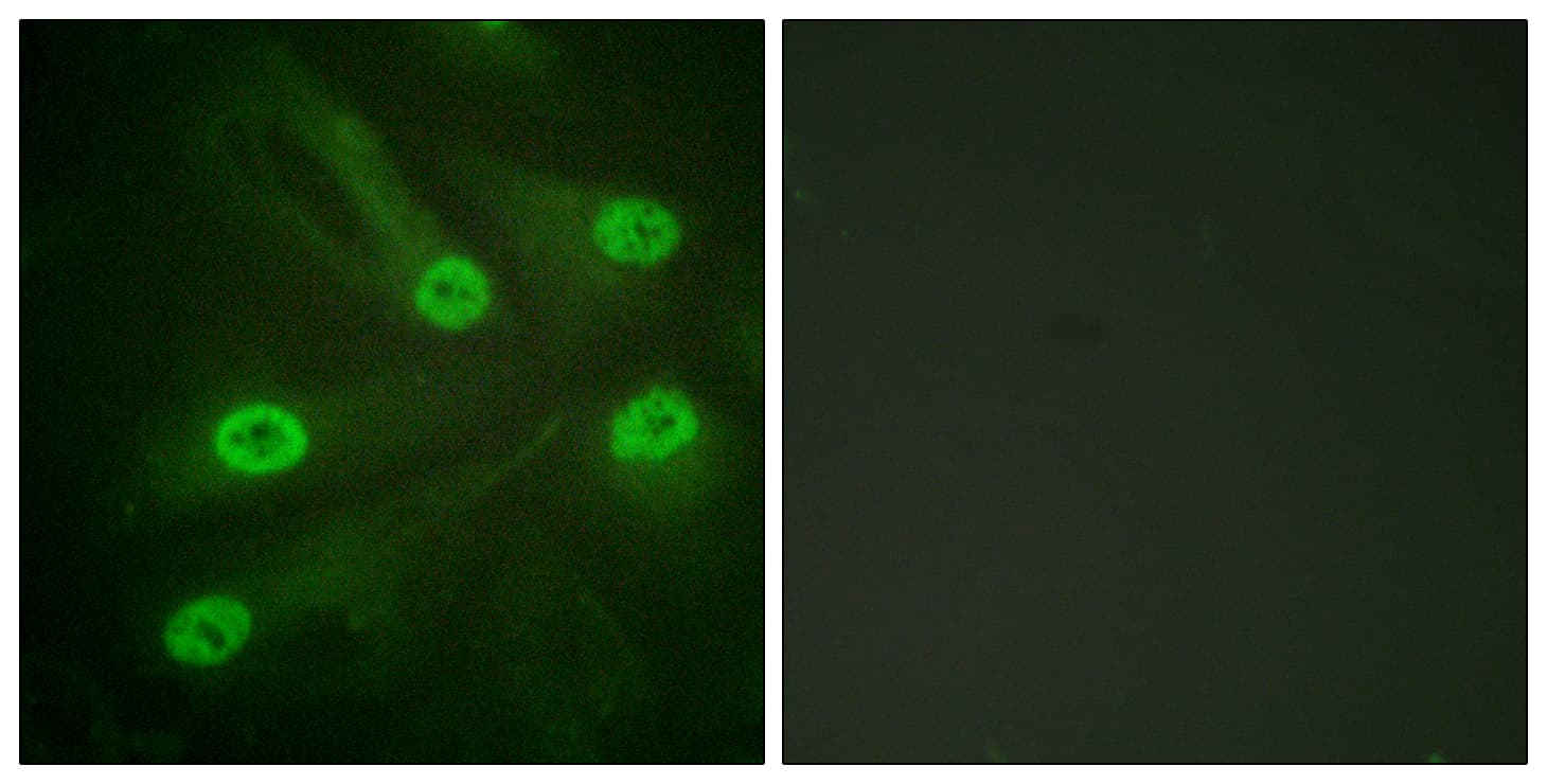 TP53 / p53 Antibody (Acetyl-Lys386)