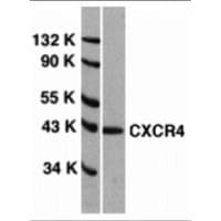 IHC-plus™ CXCR4 Antibody