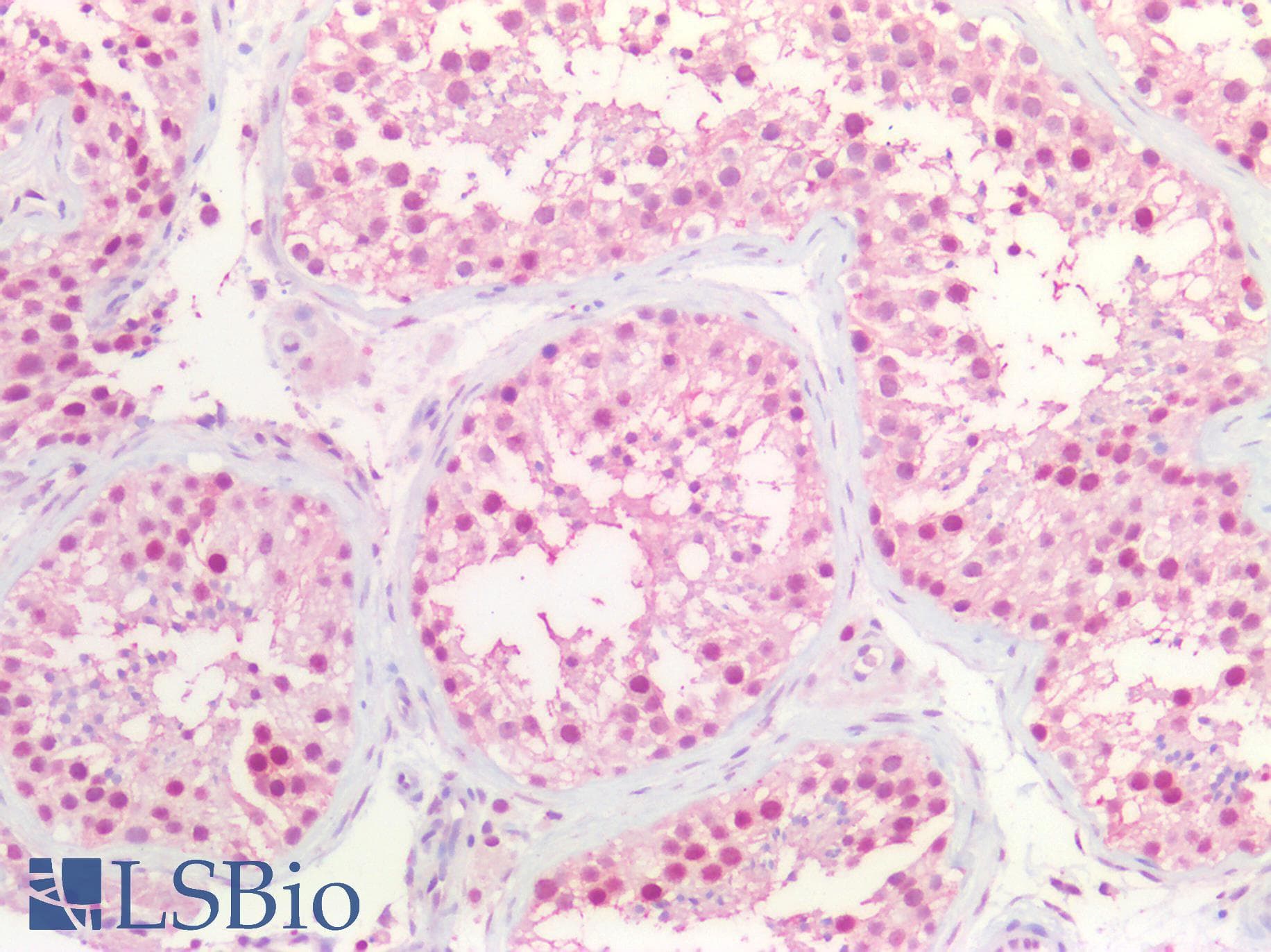 PathPlus™ CCNE1 / Cyclin E1 Antibody (aa361-410)
