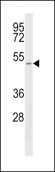 Polyclonal Rabbit anti-Human SLC16A1 / MCT1 Antibody (aa430-460, WB)