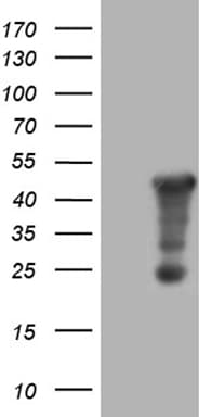 Monoclonal Mouse anti-Human AMDHD1 Antibody (clone OTI4C1, IHC, WB)