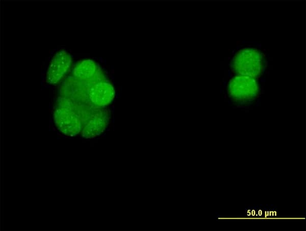 PR / Progesterone Receptor Antibody (clone 3E11)