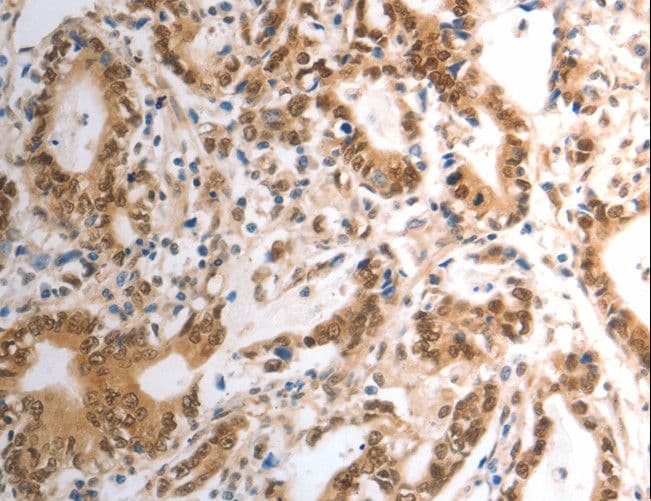 Polyclonal Rabbit anti-Human RAD50 Antibody (IHC, WB)
