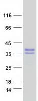 Human MAGEH1 / APR1 Protein (Recombinant Myc-DDK (Flag))