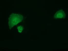 SMAD2 Antibody (clone OTI4G7)