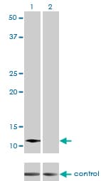 Monoclonal Mouse anti-Human ACYP2 Antibody (clone 2H7, WB)