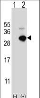 GSTO1 Antibody (aa126-155)
