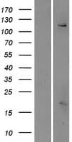 FAM62C / ESYT3 Protein (Over-Expression Lysate Myc-DDK (Flag))