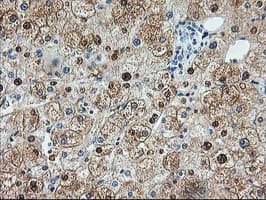 ACY1 / Aminoacylase 1 Antibody (clone OTI1A12)