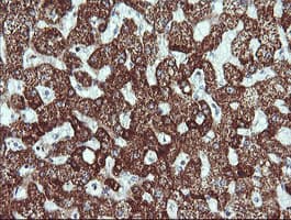 ACAA2 Antibody (clone OTI2G6)