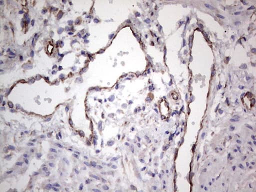 EPOR / EPO Receptor Antibody (aa25-250, clone OTI4F12)