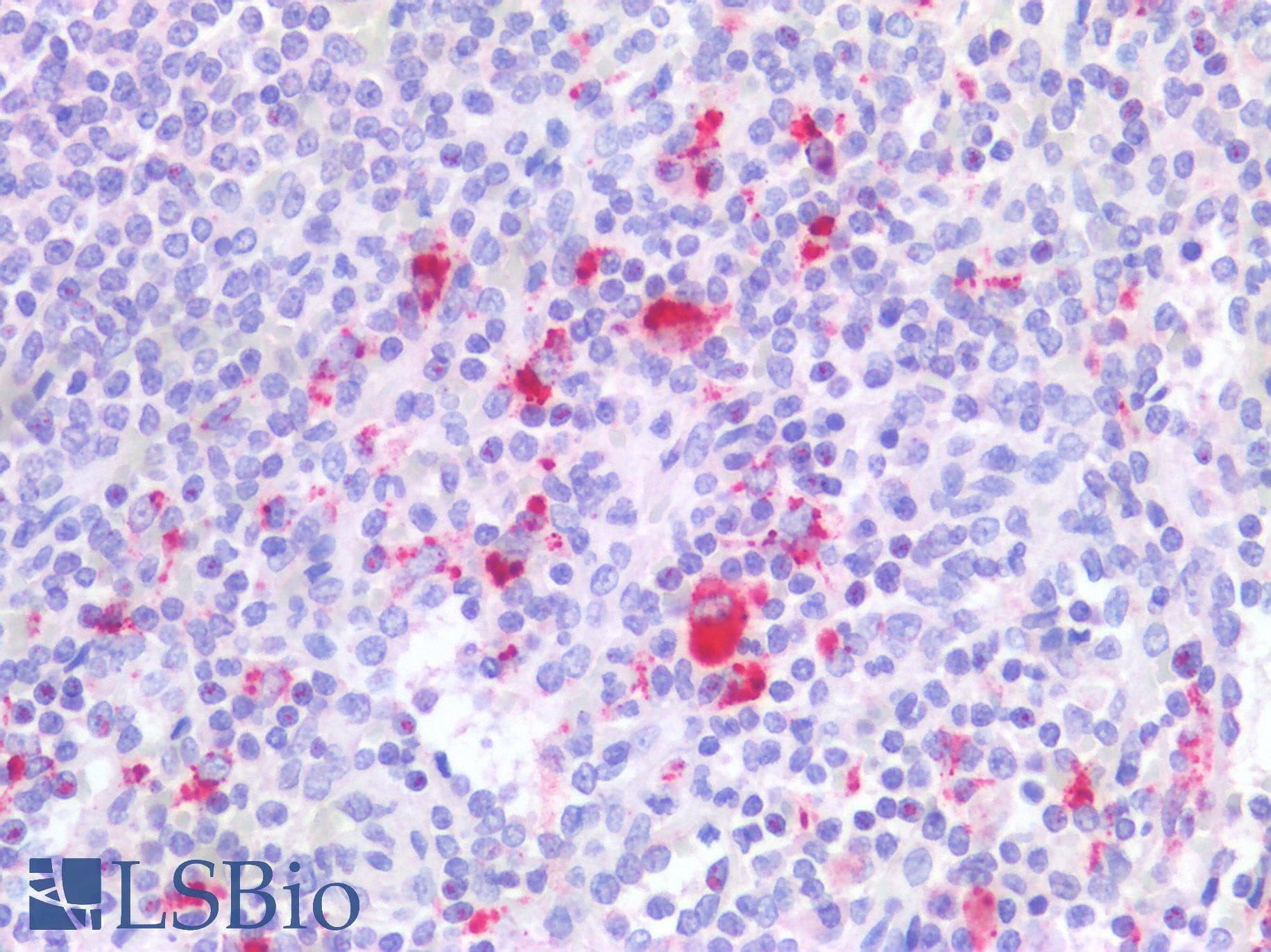 IHC-plus™ ITGB2 / CD18 Antibody (aa86-99)
