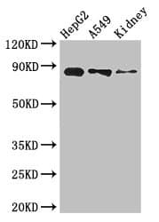 CPT1A Antibody