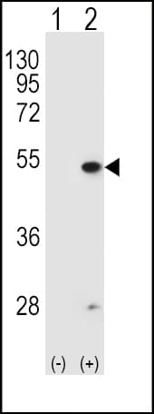 Polyclonal Rabbit anti-Human FDFT1 / Squalene Synthase Antibody (aa1-30, IHC, WB)