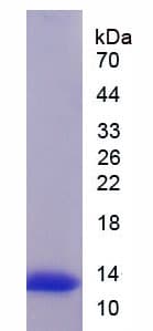 Mouse UCP1 / UCP-1 Protein (Recombinant His)