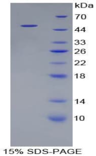 Pig CTSL / Cathepsin L Protein (Recombinant His-GST)