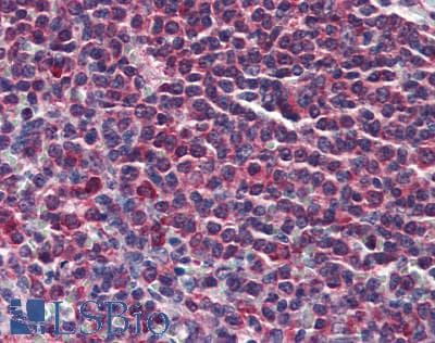 IHC-plus™ Polyclonal Rabbit anti-Human PTP1B Antibody (aa275-325, IHC)