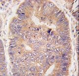 Polyclonal Rabbit anti-Human TASP1 Antibody (aa364-395, IHC, WB)