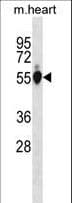 Polyclonal Rabbit anti-Mouse GPI Antibody (aa532-558, WB)