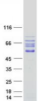Human IL16 Protein (Recombinant Myc-DDK (Flag))