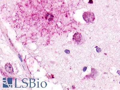 PathPlus™ Polyclonal Rabbit anti-Human GPR176 Antibody (C-Terminus, IHC)