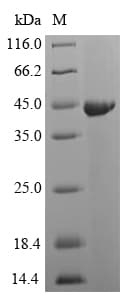 Streptococcus pyogenes speB Protein (Recombinant 6His-SUMO, N-terminus)