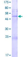 Human FGFBP2 Protein (Recombinant GST)
