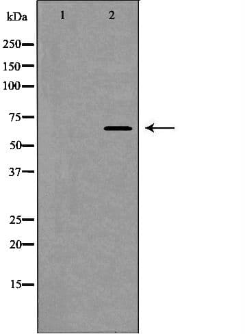 Polyclonal Rabbit anti-Human NOX4 Antibody (IHC, WB)