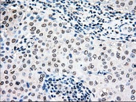MAP2K4 / MKK4 Antibody (clone OTI1D6)