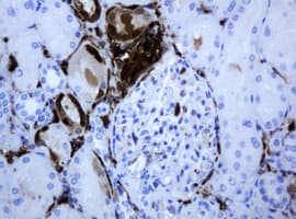 TP / Thymidine Phosphorylase Antibody (clone OTI1G10)