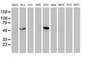 TP53 / p53 Antibody (clone OTI1D8)
