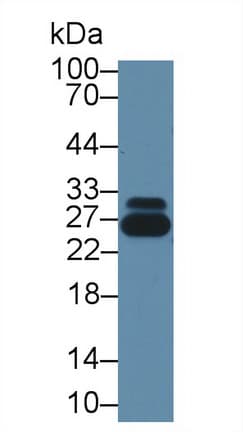 GSTP1 / GST Pi Antibody (aa1-210, APC)