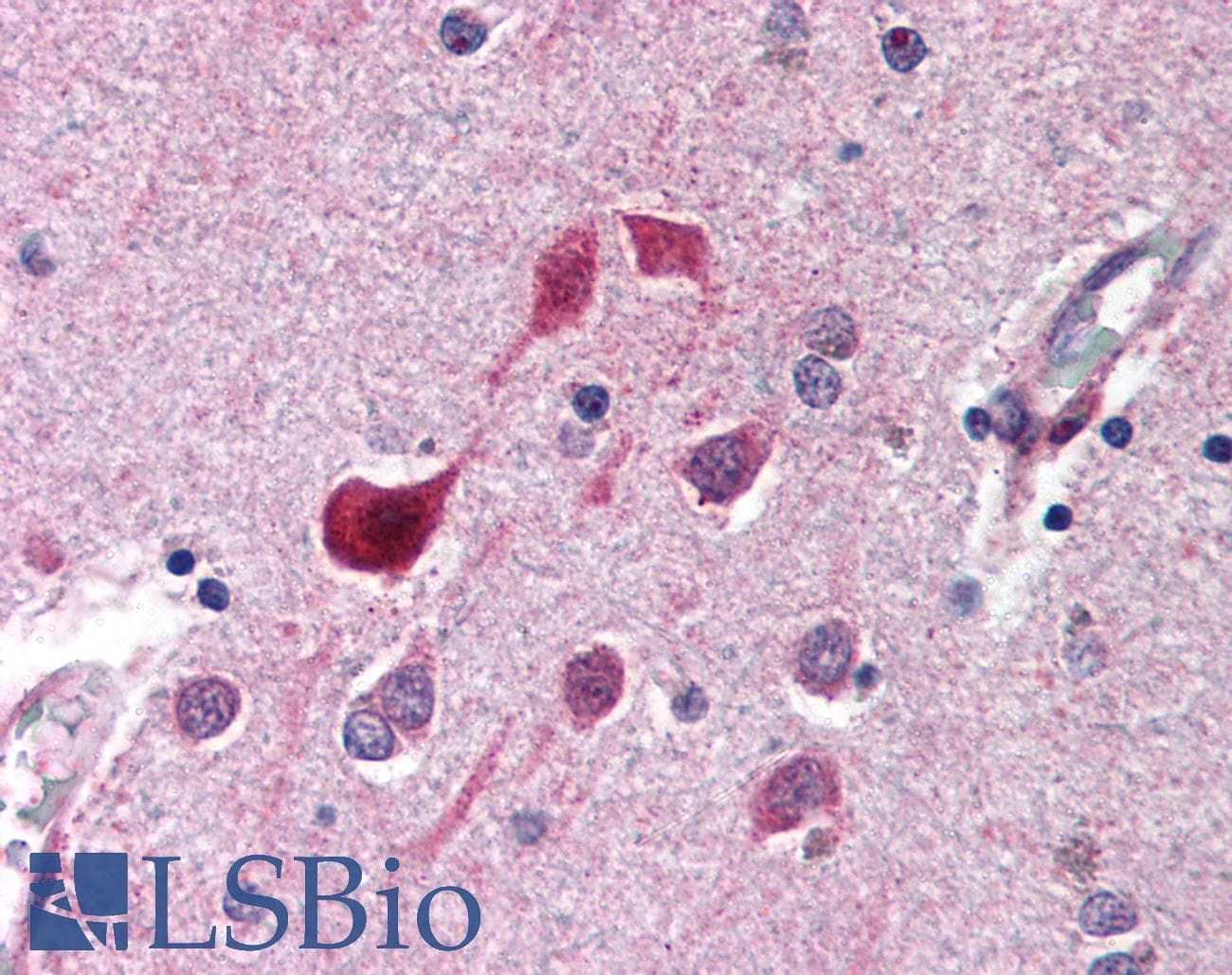 IHC-plus™ CDK5 Antibody (C-Terminus)