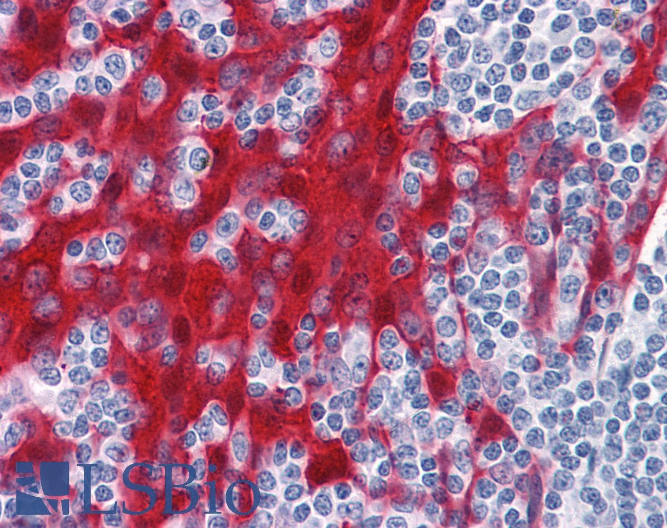 IHC-plus™ Monoclonal Mouse anti-Human SFN / Stratifin / 14-3-3 Sigma Antibody (clone 3C3, IHC, WB)