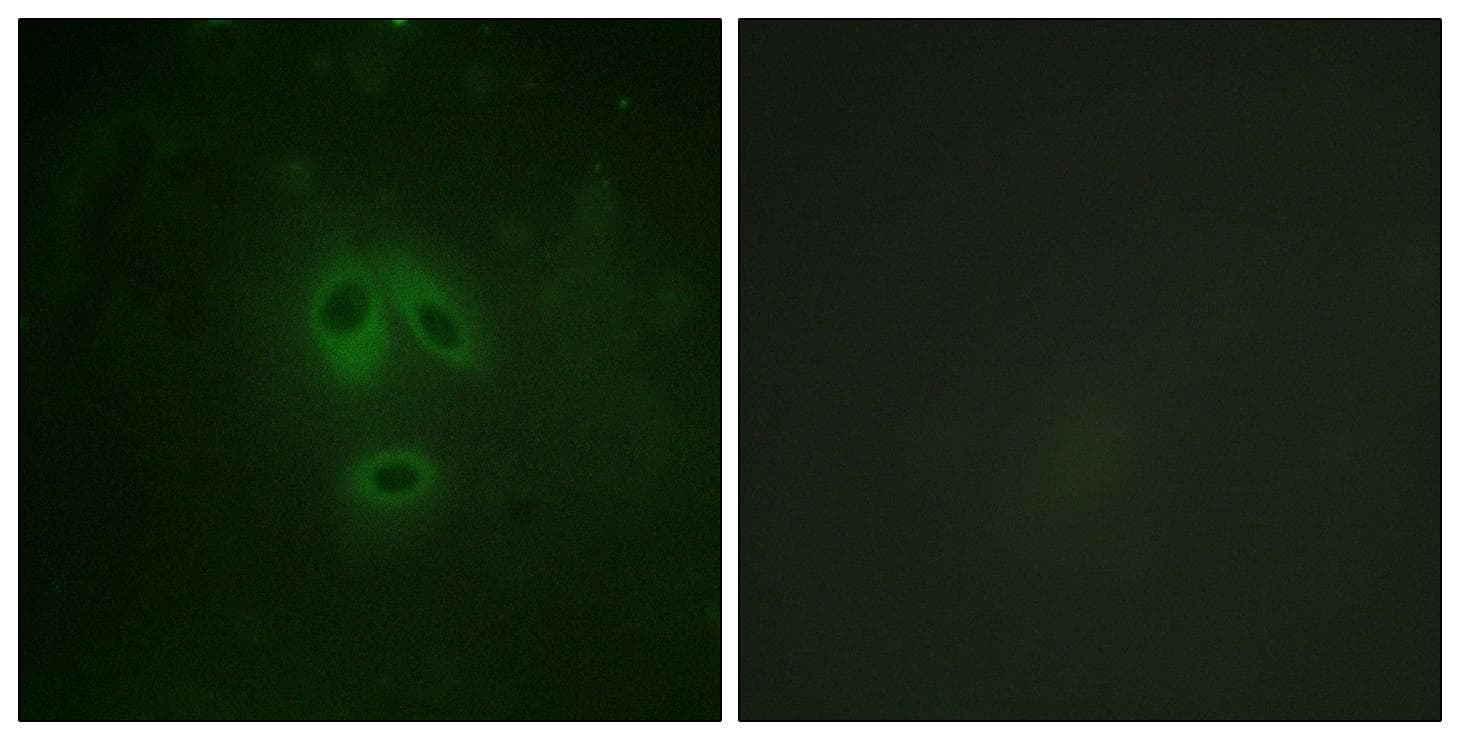 NOS1 / nNOS Antibody (phospho-Ser852)