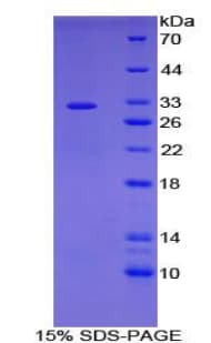 Human ADCY7 / Adenylate Cyclase 7 Protein (Recombinant His-T7)