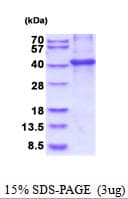 Human CNTFR Protein (Recombinant His)