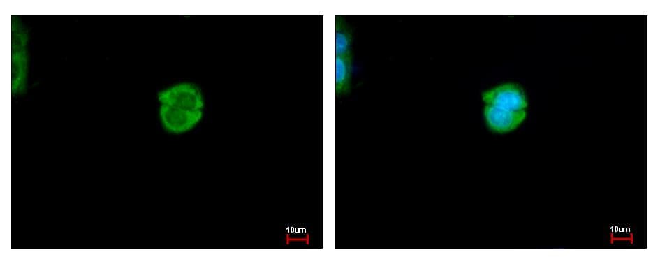 CES2 / Esterase Antibody