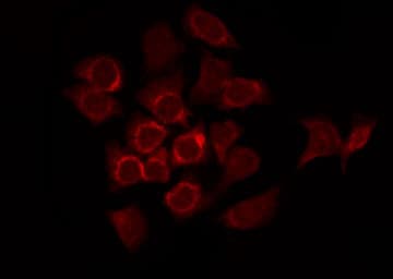 Polyclonal Rabbit anti-Human FOXO1 / FKHR Antibody (IHC, IF, WB)