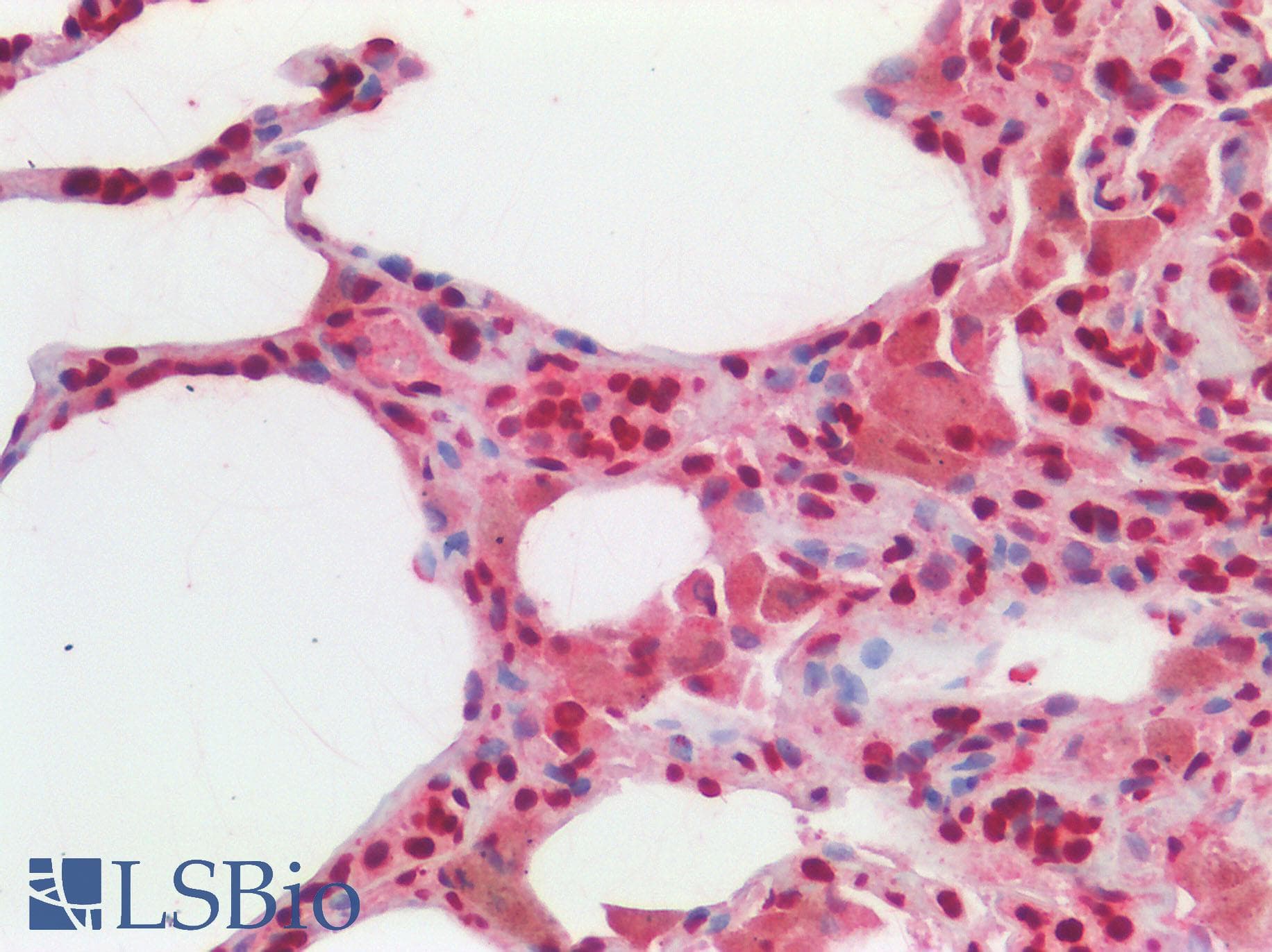 IHC-plus™ Polyclonal Rabbit anti-Human SREBF2 / SREBP2 Antibody (aa455-469, IHC, WB)