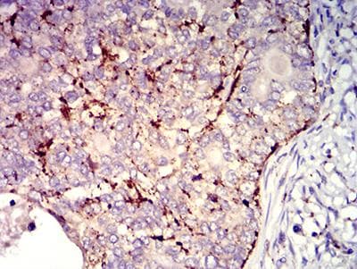 CXCR2 Antibody (clone 5F7A11)