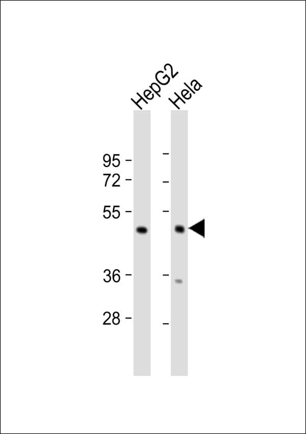 Polyclonal Rabbit anti-Human PSMC3 Antibody (WB)