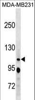 RBL1 / p107 Antibody (aa1007-1035)