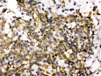 DLG4 / PSD95 Antibody