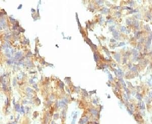 Alkaline Phosphatase Antibody (clone KSUL-1)