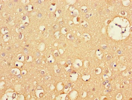 Polyclonal Rabbit anti-Human CXCL11 Antibody (IHC, IF)