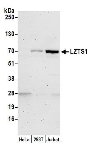 Polyclonal Rabbit anti-Human LZTS1 Antibody (aa500-550, WB)