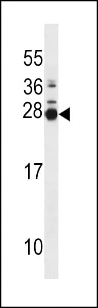 MOBKL2B / MOB3B Antibody (aa1-30)