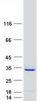 Human TREX2 Protein (Recombinant Myc-DDK (Flag))